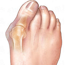 Load image into Gallery viewer, US 2PCS Silicone Gel Bunion Splint Big Toe Separator Straightener Spreader Hallux Valgus Toe Correctors Foots Care Tool Massager
